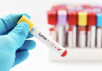 Global Lyme Alliance and DiaSorin Announce Partnership Seeking Study Volunteers to Advance an Innovative Lyme Disease Diagnostic