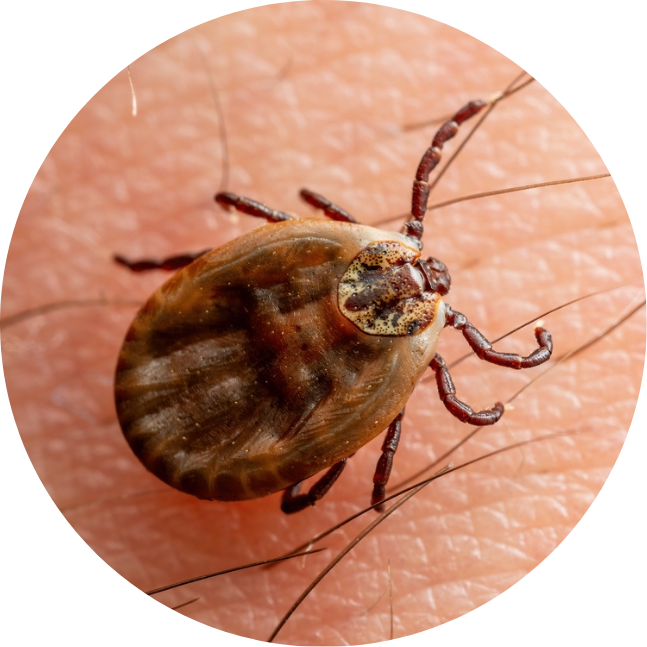 Babesiosis Infected Tick